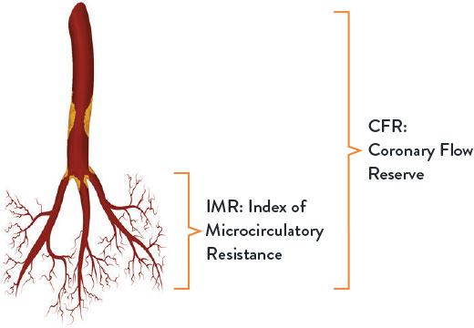 Assessment for a Coronary Microvascular Dysfunction Diagnosis