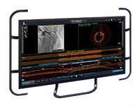 OPTIS NEXT Imaging Systems