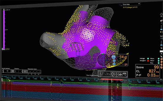 EnSite X EP system mapping