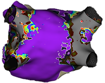 EnSite X EP system mapping