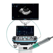 ViewMate Ultrasound Console with ViewFlex Xtra ICE Catheter