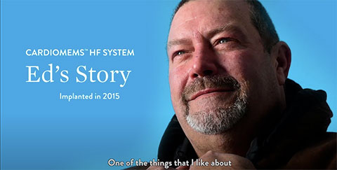 Hear From Patients Who Have The CardioMEMS HF System