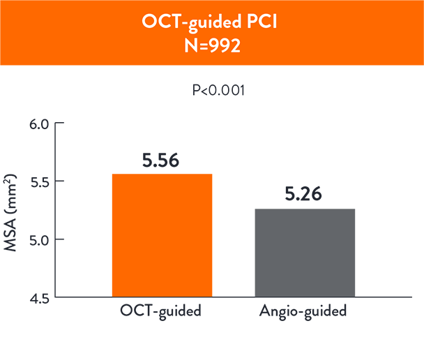 OCT Guided PCI chart